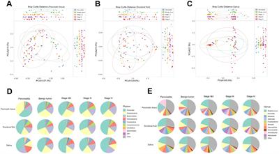 Succession of the multi-site microbiome along pancreatic ductal adenocarcinoma tumorigenesis